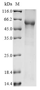 Recombinant Human Zinc finger CCCH domain-containing protein 7B(ZC3H7B),partial