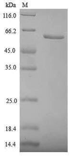 Recombinant Human Zona pellucida sperm-binding protein 3(ZP3) ,partial