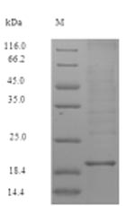 Recombinant Human Zymogen granule protein 16 homolog B(ZG16B)