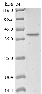 Recombinant Human adenovirus B serotype 11 Fiber protein(L5)