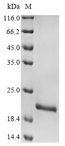 Recombinant Human adenovirus C serotype 2 Early E3 18.5 kDa glycoprotein,partial