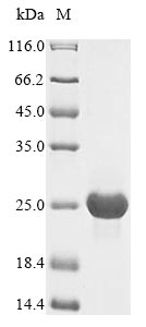 Recombinant Human cytomegalovirus Uncharacterized protein UL128(UL128)