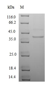 Recombinant Human cytomegalovirus Uncharacterized protein UL130(UL130),partial