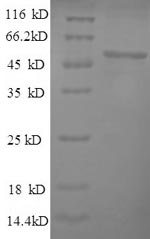Recombinant Human herpesvirus 1 Thymidine kinase(TK)
