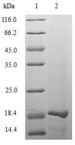 Recombinant Human herpesvirus 2 Tegument protein VP22 (UL49),partial