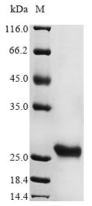 Recombinant Human herpesvirus 6A Probable ganciclovir kinase(U69),partial