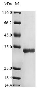 Recombinant Human herpesvirus 6B mRNA export factor ICP27 homolog(KA3L),partial