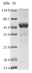 Recombinant Human metapneumovirus Nucleoprotein(N)