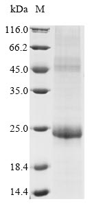 Recombinant Human papillomavirus type 11 Replication protein E1(E1),partial