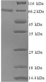 Recombinant Human papillomavirus type 16 Minor capsid protein L2(L2)
