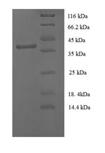 Recombinant Human papillomavirus type 16 Protein E7(E7)