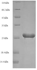 Recombinant Human papillomavirus type 52 Protein E7(E7)