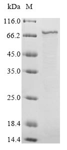 Recombinant Human respiratory syncytial virus A Fusion glycoprotein F0(F),partial