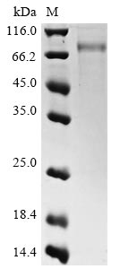 Recombinant Influenza A virus Hemagglutinin(HA),partial