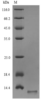 Recombinant Influenza A virus Matrix protein 2(M),partial