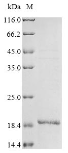Recombinant Influenza A virus Matrix protein 2(M),partial