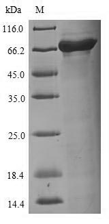 Recombinant Influenza A virus Nucleoprotein(NP)