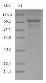 Recombinant Influenza A virus Nucleoprotein(NP)