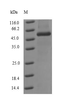 Recombinant Influenza A virus Nucleoprotein(NP)