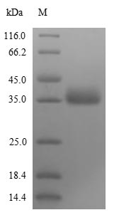 Recombinant Influenza B virus Non-structural protein 1(NS)