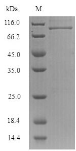 Recombinant Influenza B virus Nucleoprotein(NP) 