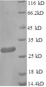 Recombinant Klebsiella pneumoniae Metallo-beta-lactamase type 2(blaNDM-1)