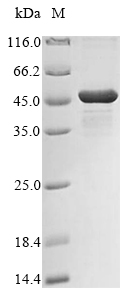 Recombinant Klebsiella pneumoniae UDP-3-O-acyl-N-acetylglucosamine deacetylase(lpxC)
