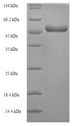 Recombinant Lake Victoria marburgvirus Matrix protein VP40(VP40)