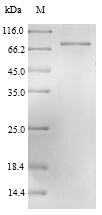 Recombinant Lassa virus Nucleoprotein(N)