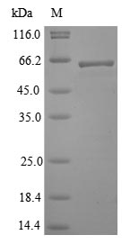 Recombinant Lassa virus Nucleoprotein(N)
