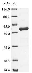 Recombinant Legionella pneumophila Aspartate-semialdehyde dehydrogenase(asd)