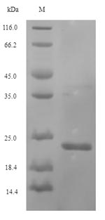 Recombinant Legionella pneumophila Peptidoglycan-associated lipoprotein(pal)