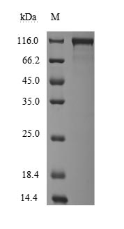 Recombinant Macaca fascicularis Angiotensin-converting enzyme(ACE2),partial (Active)