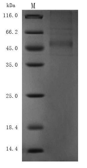 Recombinant Macaca fascicularis Delta-like protein 3(DLL3),partial (Active)