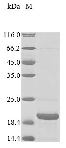 Recombinant Macaca fascicularis Parathyroid hormone(PTH)