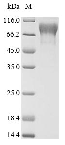 Recombinant Macaca fascicularis Trophoblast glycoprotein(TPBG),partial