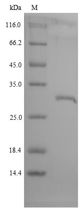 Recombinant Macaca mulatta Growth hormone receptor(GHR),partial