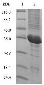 Recombinant Macaca mulatta Interleukin-2(IL2)