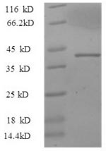 Recombinant Macaca mulatta Uncharacterized protein(IL17A)