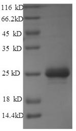 Recombinant Mannheimia haemolytica Leukotoxin(lktA),partial