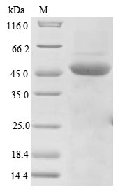 Recombinant Measles virus Nucleoprotein(N),partial