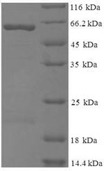 Recombinant Moloney murine leukemia virus Gag polyprotein(gag),partial  