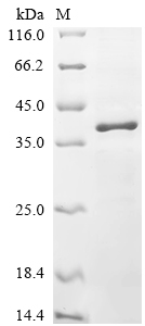 Recombinant Mouse 5-AMP-activated protein kinase catalytic subunit alpha-1(Prkaa1),partial