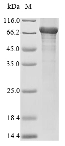 Recombinant Mouse 5-aminolevulinate synthase, nonspecific, mitochondrial(Alas1)