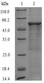 Recombinant Mouse 60S acidic ribosomal protein P0(Rplp0)
