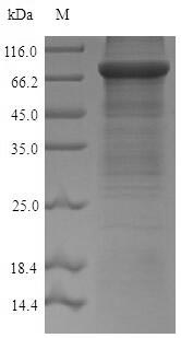 Recombinant Mouse Acetyl-coenzyme A synthetase, Cytoplasmic domain(Acss2)