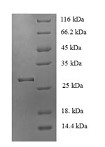 Recombinant Mouse Acetylcholine receptor subunit alpha(Chrna1),partial