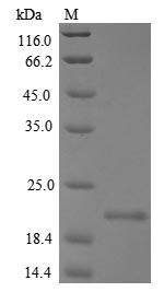 Recombinant Mouse Allergin-1(Milr1),partial