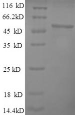 Recombinant Mouse Alpha-enolase(Eno1),partial