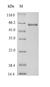 Recombinant Mouse Alpha-fetoprotein(Afp)